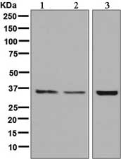 All lanes : Anti-Aquaporin 8 antibody [EPR8397] (ab133667) at 1/1000 dilutionLane 1 : HeLa cell lysateLane 2 : BxPC-3 cell lysateLane 3 : Caco-2 cell lysateLysates/proteins at 10 µg per lane.SecondaryHRP labelled goat anti-rabbit at 1/2000 dilution