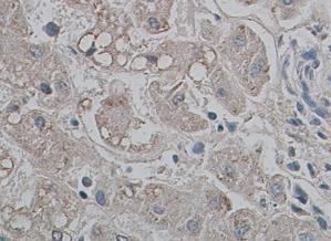 ab84828, at 1/100 dilution, staining Aquaporin 9 in formalin-fixed, paraffin-embedded Human liver tissue by immunohistochemistry. Membrane staining is observed.
