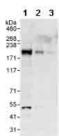 All lanes : Anti-ARAP1 antibody (ab99382) at 0.1 µg/mlLane 1 : HeLa whole cell lysate at 50 µgLane 2 : HeLa whole cell lysate at 15 µgLane 3 : HeLa whole cell lysate at 5 µg
