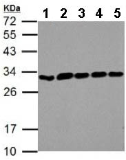 All lanes : Anti-ARD1A antibody (ab155687) at 1/1000 dilutionLane 1 : NIH 3T3 whole cell lysateLane 2 : JC whole cell lysateLane 3 : BCL1 whole cell lysateLane 4 : C2C12 whole cell lysateLane 5 : RAW264.7 whole cell lysateLysates/proteins at 30 µg per lane.
