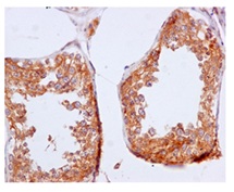 Immunohistochemistry of paraffin-embedded Human testis tissue labeling ARF4 using ab171746 at 1/100 dilution.