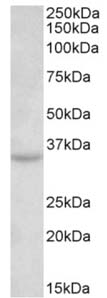 Anti- TSPAN5 antibody (ab156816) at 0.3 µg/ml + Mouse brain lysate at 35 µgdeveloped using the ECL technique