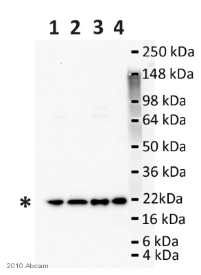 All lanes : Anti-ARF6 antibody (ab77581) at 1 µg/mlLane 1 : Lysates prepared from Mouse liver tissue.Lane 2 : Lysates prepared from Mouse lung tissue.Lane 3 : Lysates prepared from Rat liver tissue.Lane 4 : Lysates prepared from Rat lung tissue.Lysates/proteins at 20 µg per lane.SecondaryHRP-conjugated Pig polyclonal to rabbit IgG at 1/5000 dilutionPerformed under reducing conditions.