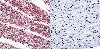 Immunohistochemical analysis of deparaffinized Human heart tissue labelling ARF6 with ab155929 at 1/20. The panel on the right shows the tissue without primary antibody incubation (negative control).
