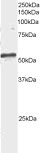ARFGAP3 staining (2µg/ml) of Mouse Brain extracts (RIPA buffer, 35µg total protein per lane). Primary incubated for 1 hour. Detected by western blot using chemiluminescence