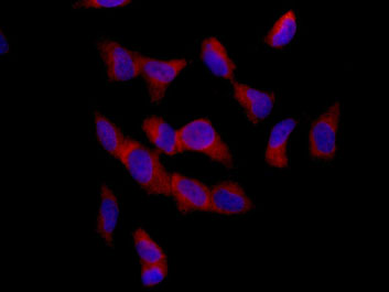 Immunofluorescent analysis of 4% paraformaldehyde-fixed SH-SY5Y cells labeling ARFIP2 with ab180503 at 1/1000 dilution, followed by Goat anti rabbit IgG (Dylight 555) secondary antibody at 1/250 dilution. Counter stained with DAPI.