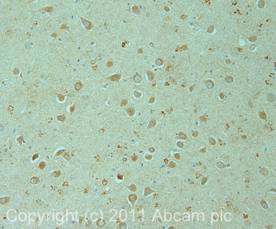 IHC image of ab85656 staining in human hippocampus formalin fixed paraffin embedded tissue section, performed on a Leica BondTM system using the standard protocol F. The section was pre-treated using heat mediated antigen retrieval with sodium citrate buffer (pH6, epitope retrieval solution 1) for 20 mins. The section was then incubated with ab85656, 1µg/ml, for 15 mins at room temperature and detected using an HRP conjugated compact polymer system. DAB was used as the chromogen. The section was then counterstained with haematoxylin and mounted with DPX.For other IHC staining systems (automated and non-automated) customers should optimize variable parameters such as antigen retrieval conditions, primary antibody concentration and antibody incubation times.