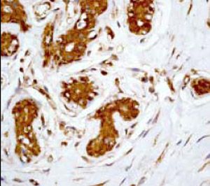 Ab32560, at a 1/500 dilution, staining 14-3-3 alpha + beta in paraffin embedded human breast tissue by Immunohistochemistry.