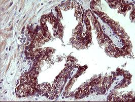 Immunohistochemical analysis of paraffin-embedded Human prostate tissue labeling Arg2 with ab170159 at 1/150 dilution.