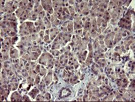 Immunohistochemical analysis of paraffin-embedded Human pancreas tissue labeling Arg2 with ab170159 at 1/150 dilution.