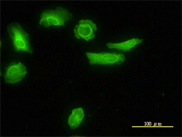 ARH antibody (ab57261) used in immunofluorescence at 10ug/ml on HeLa cells.