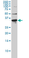 ARH antibody (ab57261) at 1ug/lane + HeLa cell lysate at 25ug/lane.