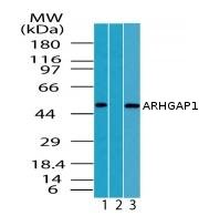 All lanes : Anti-ARHGAP1 antibody (ab72127) at 0.5 µg/mlLane 1 : HeLa cell lysateLane 2 : HeLa cell lysate with immunising peptideLane 3 : Raw cell lysate