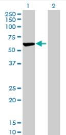 All lanes : Anti-ARHGAP15 antibody (ab69068) at 1/500 dilutionLane 1 : ARHGAP15 transfected 293T cell lysateLane 2 : Non-transfected 293T cell lysateLysates/proteins at 25 µg per lane.SecondaryGoat anti-mouse IgG (H&L)-HRP conjugated at 1/2500 dilution