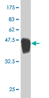 Western blot against tagged recombinant protein immunogen using ab54841 ARHGDIG antibody at 1ug/ml.