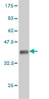 Western blot against tagged recombinant protein immunogen using ab56568 ARHGEF11 antibody at 1ug/ml.