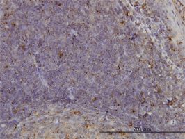 ARHGEF14 antibody (ab57401) used in immunohistochemistry at 1ug/ml on formalin fixed and paraffin embedded human tonsil.