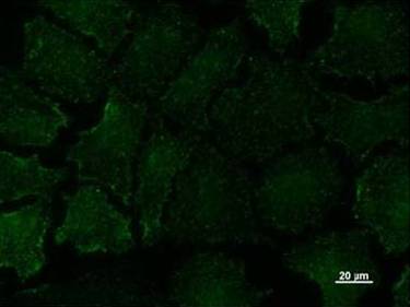 HeLa cells stained with ab51019 at 1/5 dilution, followed by Alexa Fluor 488 Goat Anti-Mouse IgG at 1/200 dilution.