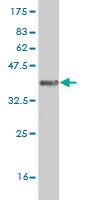 Western blot against tagged recombinant protein immunogen using ab56712 ARIH2 antibody at 1ug/ml.