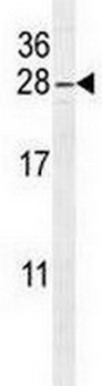 Anti-ARL5B antibody - C-terminal (ab170810) at 1/50 dilution + CEM cell lysate at 35 µgdeveloped using the ECL technique