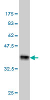 Western blot against tagged recombinant protein immunogen using ab57353 ARMCX1 antibody at 1ug/ml.