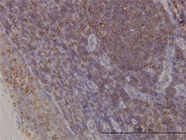 Arp3 antibody (ab56817) used in immunohistochemistry at 6ug/ml on formalin fixed and paraffin embedded human tonsil.
