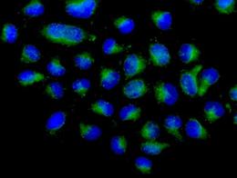 Immunofluorescence analysis of -20°C Acetone fixed HeLa cells labeling Arp3 with ab181164 at a 1/100 dilution. Goat anti rabbit IgG (Alexa Fluor® 488) secondary used at a 1/200 diution.