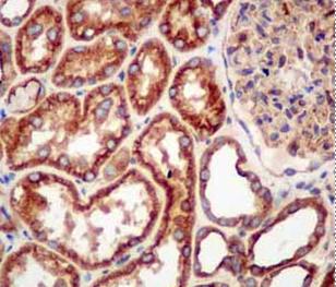 Immunohistochemical analysis of paraffin embedded Human kidney tissue labeling Arp3 with ab181164 at a 1/250 dilution. Prediluted HRP Rabbit IgG secondary was used. Counterstained with Hematoxylin.