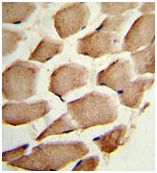 Immunohistochemical analysis of formalin-fixed, paraffin-embedded Human skeletal muscle tissue labelled with ab135572 at 1/50 dilution. ab135572 was peroxidase-conjugated to the secondary antibody, followed by DAB staining.