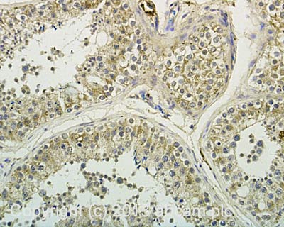 IHC image of ABCA12 staining in Human normal testis formalin fixed paraffin embedded tissue section, performed on a Leica Bond™ system using the standard protocol F. The section was pre-treated using heat mediated antigen retrieval with sodium citrate buffer (pH6, epitope retrieval solution 1) for 20 mins. The section was then incubated with ab154037, 10µg/ml, for 15 mins at room temperature and detected using an HRP conjugated compact polymer system. DAB was used as the chromogen. The section was then counterstained with haematoxylin and mounted with DPX. For other IHC staining systems (automated and non-automated) customers should optimize variable parameters such as antigen retrieval conditions, primary antibody concentration and antibody incubation times.