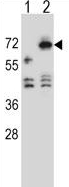 All lanes : Anti-ARSF antibody (ab171642) at 1/100 dilutionLane 1 : 293 cell lysates nontransfectedLane 2 : 293 cell lysates transiently transfected with the ARSF geneLysates/proteins at 2 µg per lane.