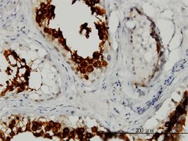 ART3 antibody (ab54805) used in immunohistochemistry at 2ug/ml on formalin fixed and paraffin embedded human testis.