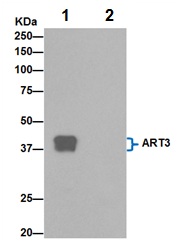 Immunoprecipitation analysis of Human testis lysate labeling ART3 using ab192870 at 1/20 dilution (Lane 1). PBS negative control (Lane 2). Anti-Rabbit IgG (HRP), specific to the non-reduced form of IgG at 1/1500 was used as the secondary antibodyNote: The band observed at 41 kDa may be due to the removal of a 27 amino acid propeptide (mature form).