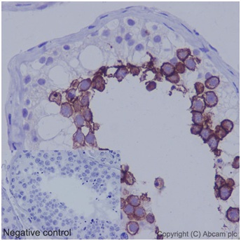 Immunohistochemical analysis of paraffin-embedded Human testis tissue labeling ART3 using ab192870 at 1/500 dilution (0.6 μg/ml). A prediluted HRP Polymer for Rabbit IgG was used as secondary. Counterstain: Hematoxylin. Negative control also shown.