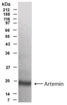 Anti-Artemin antibody - Aminoterminal end (ab45506) at 1/500 dilution (incubated over night at 4C.) + dorsal root ganglia/CNS preparation.developed using the ECL technique
