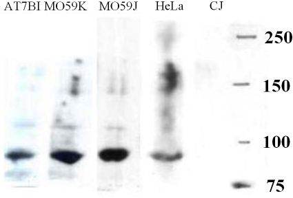 All lanes : Anti-Artemis antibody (ab3834) at 2.4 µg/mlLane 1 : AT7BI whole cell lysateLane 2 : MO59K whole cell lysateLane 3 : MO59J whole cell lysateLane 4 : HeLa whole cell lysateLane 5 : CJ whole cell lysate