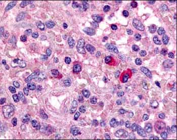 IHC-P of human spleen using ab3834 at a 1:1000 dilution.  Positive staining of T cells and B lymphocytes is observed.