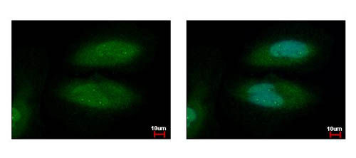 Immunofluorescent analysis of paraformaldehyde-fixed HeLa cells labeling Aryl hydrocarbon Receptor with ab153744 at 1/500 dilution. Blue: Hoechst 33342 staining.