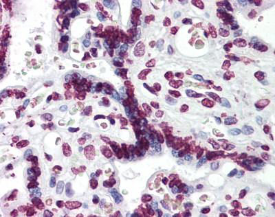 ab124222, at 5 µg/ml, staining Aryl hydrocarbon Receptor in formalin fixed, paraffin embedded Human placenta tissue by Immunohistochemistry.