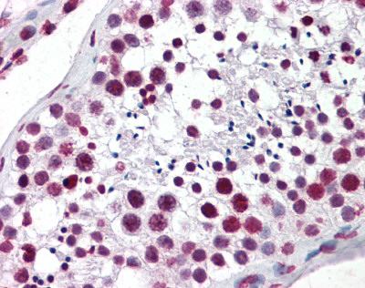 ab124222, at 5 µg/ml, staining Aryl hydrocarbon Receptor in formalin fixed, paraffin embedded Human testis tissue by Immunohistochemistry.