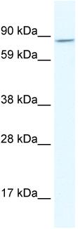 Anti-Aryl hydrocarbon Receptor antibody (ab28698) at 2.5 µg/ml + Human placental lysateSecondaryHRP conjugated anti-Rabbit IgG at 1/50000 dilutionObserved band size : 85 kDa (why is the actual band size different from the predicted?)