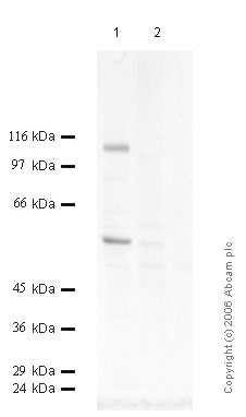 All lanes : Anti-DPP6 antibody - Catalytic domain (ab41811) at 1/1000 dilutionLane 1 : Mouse BrainLane 2 : DU145 / IL1-beta Cell media