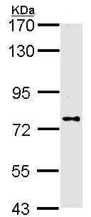 Anti-DPP8 antibody (ab96470) at 1/1000 dilution + A431 whole cell lysate at 30 µg
