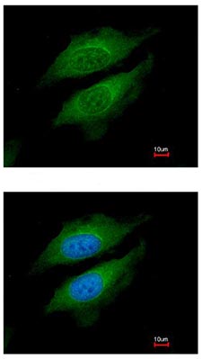 ab96470, at a 1/200 dilution, staining DPP8 in paraformaldehyde fixed HeLa cells by Immunofluorescence. Lower image is merged with DNA probe.