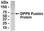 Anti-DPP9 antibody (ab26177) at 1/2000 dilutionSecondaryGoat anti-IgY-HRP at 1/1000 dilution