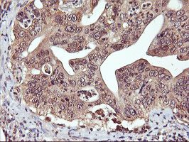 ab119808 at 1/150 dilution staining DPP9 in Paraffin-embedded Human Pancreas tissue by Immunohistochemistry.