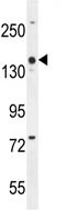 Anti-Cordon bleu homolog antibody (ab107598) at 1/100 dilution + Mouse kidney tissue lysate at 35 µg