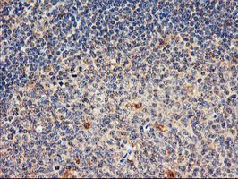 ab119808 at 1/150 dilution staining DPP9 in Paraffin-embedded Human Tonsil tissue by Immunohistochemistry.