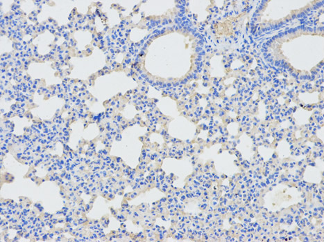 Immunohistochemistry (Formalin/PFA-fixed paraffin-embedded sections) analysis of mouse lung tissue labelling DPYD with ab180609 at 1/100. Magnification: 200x.