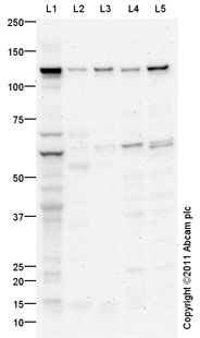 All lanes : Anti-DPYD antibody (ab95834) at 1 µg/mlLane 1 : Liver (Human) Tissue Lysate - adult normal tissue (ab29889)Lane 2 : Kidney (Human) Tissue Lysate - adult normal tissue (ab30203)Lane 3 : Spleen (Human) Tissue Lysate - adult normal tissue (ab29699)Lane 4 : Jurkat (Human T cell lymphoblast-like cell line) Whole Cell Lysate Lane 5 : THP1 (Human acute monocytic leukemia cell line) Whole Cell LysateLysates/proteins at 10 µg per lane.SecondaryGoat Anti-Rabbit IgG H&L (HRP) preadsorbed (ab97080) at 1/5000 dilutiondeveloped using the ECL techniquePerformed under reducing conditions.